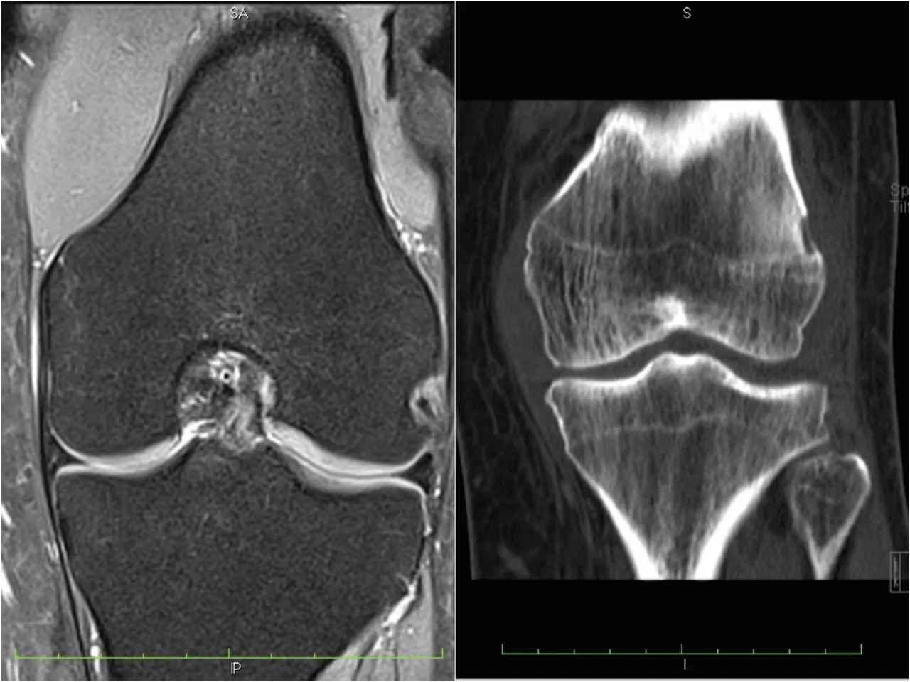 badania diagnostyczne kości RTG MRI