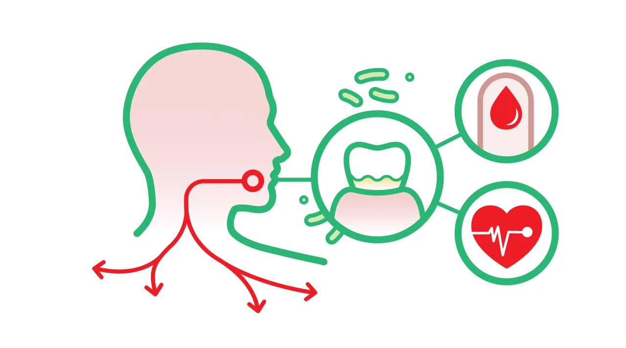 różne przyczyny bólu dziąseł infografika