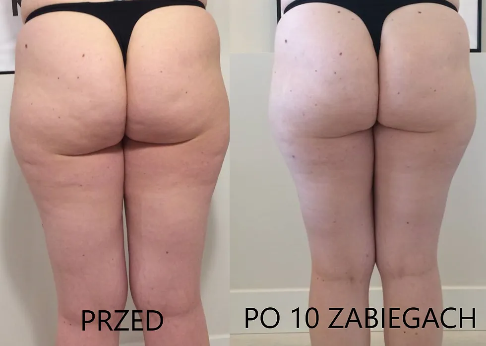 masaż bańką chińską przed i po