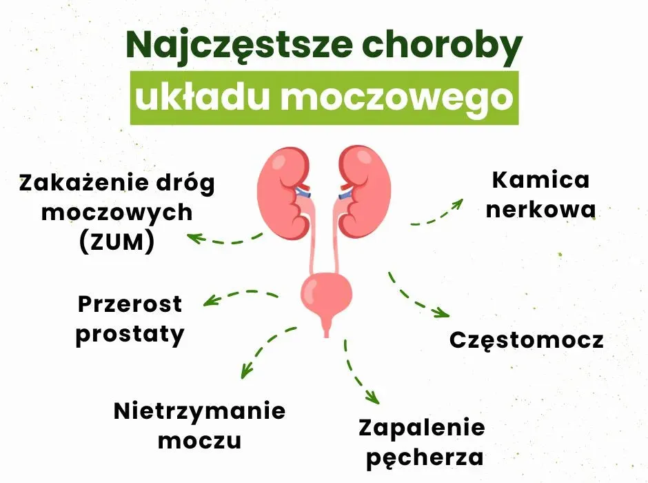 Objawy chorób układu moczowego i płciowego