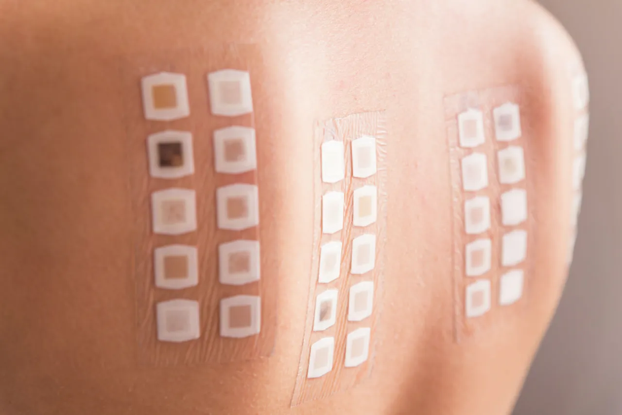 Uczulenie na kosmetyki objawy na skórze