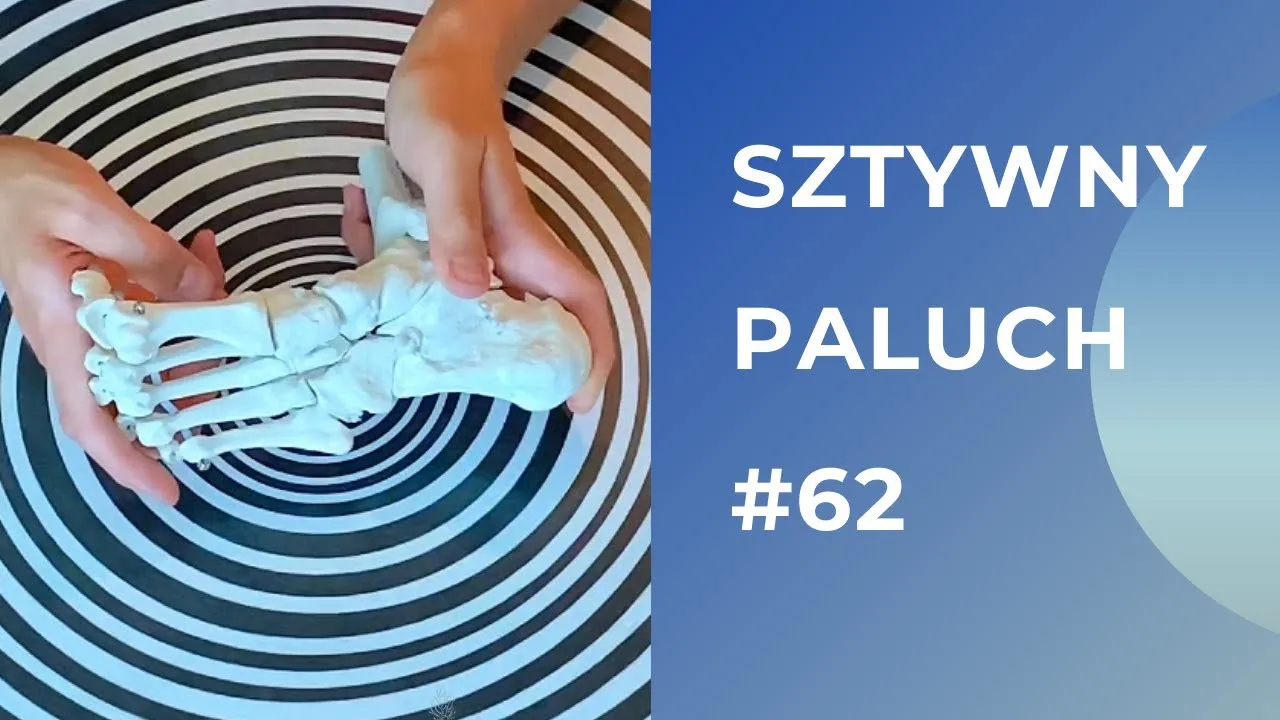Zdjęcie Jakie ćwiczenia po operacji palucha sztywnego pomogą w rehabilitacji