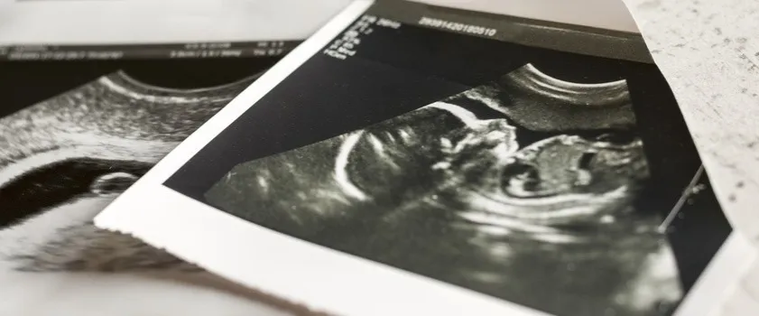 Zdjęcie Kiedy USG wykaże ciążę? Poznaj kluczowe informacje i terminy