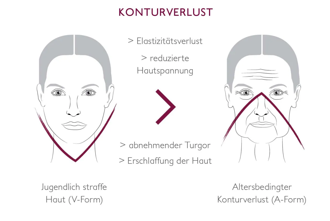 Gesichtshaut verliert an Spannkraft Ursachen