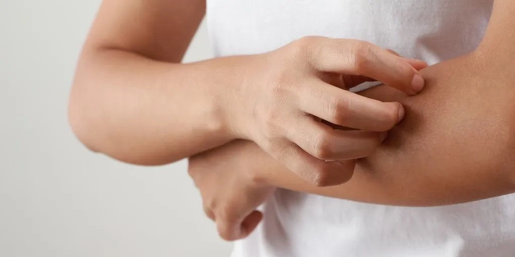 alergia na roztocza objawy skórne