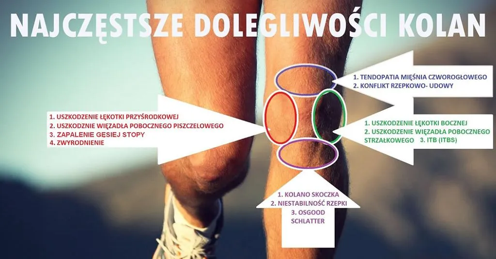 Skręcenie kolana stopnie urazu infografika