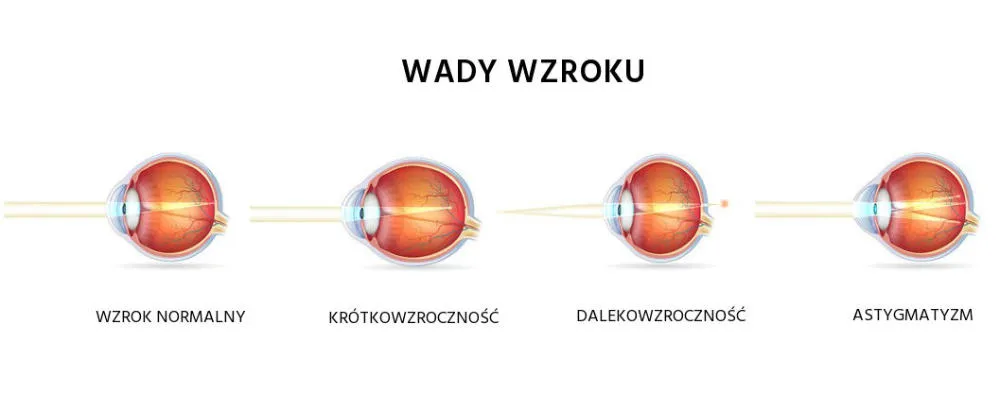 różne typy okularów i soczewek kontaktowych do korekcji astygmatyzmu