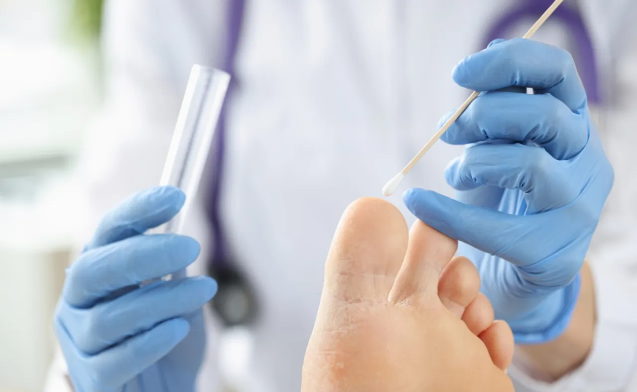Rodzaje badań mykologicznych paznokci