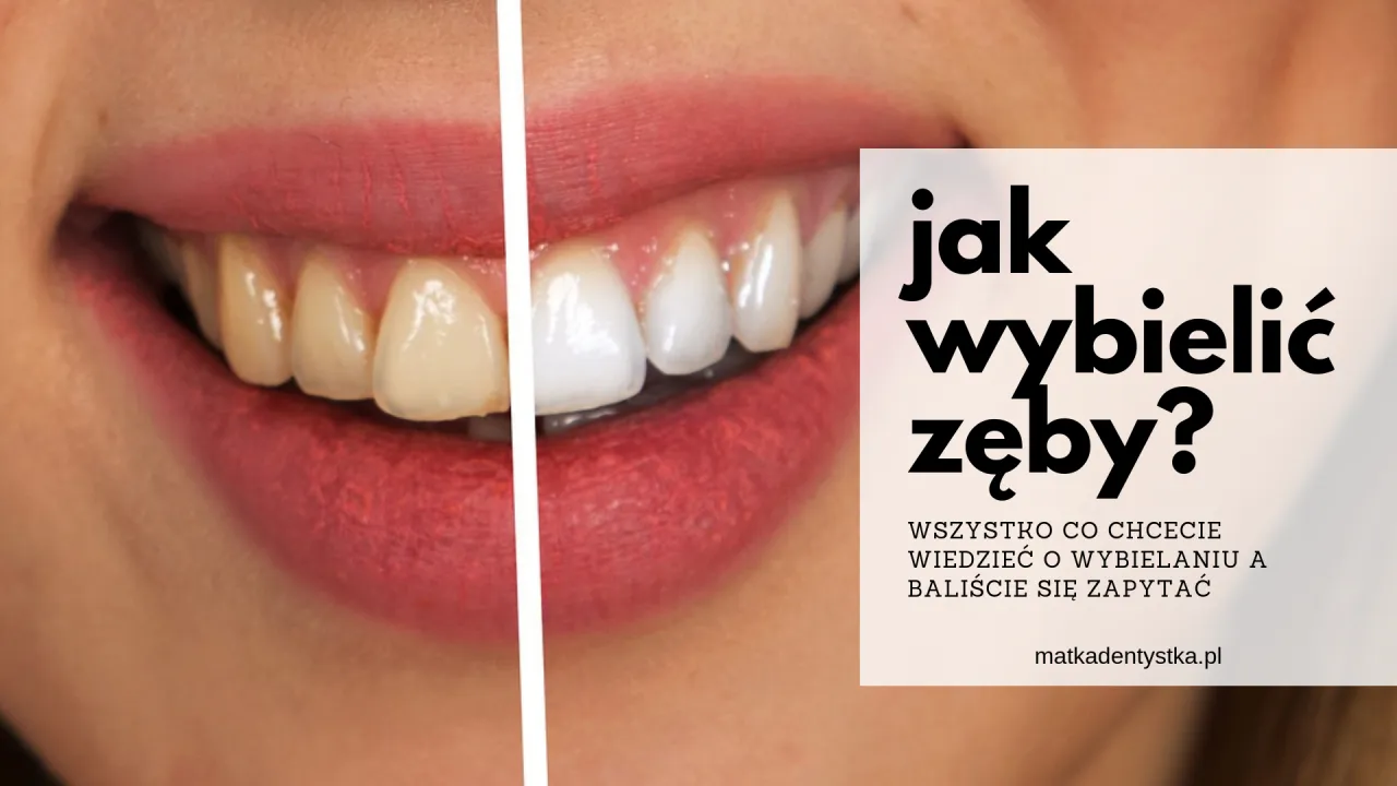 por&oacute;wnanie metod wybielania zęb&oacute;w gabinetowe nakładkowe