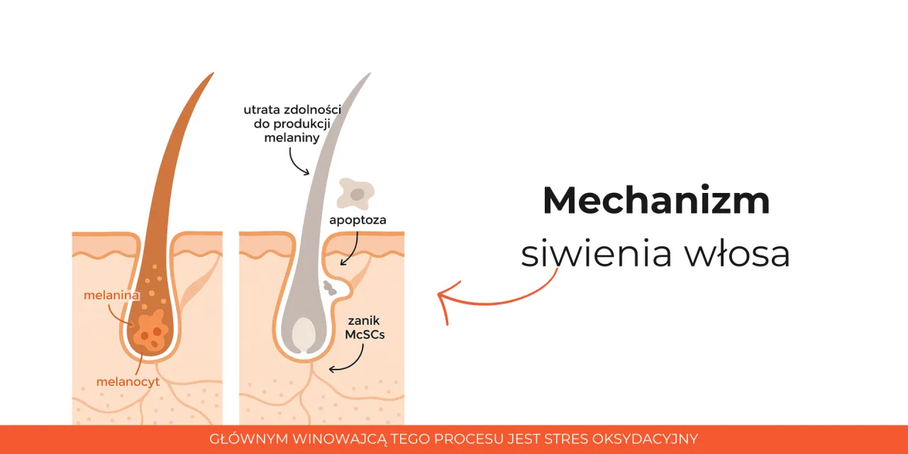 mechanizm siwienia włos&oacute;w melanocyty