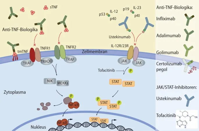 JAK-Inhibitoren Wirkmechanismus Morbus Crohn