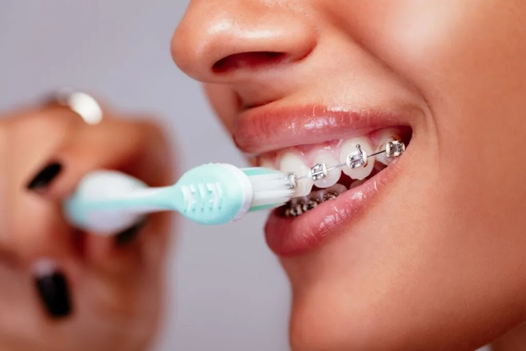 Osoba z aparatem ortodontycznym szczotkująca zęby