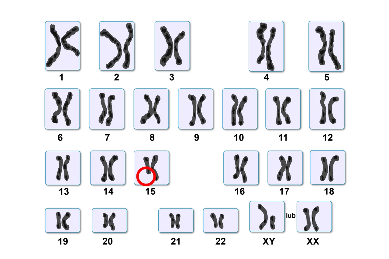 kobieta kariotyp 46 XX
