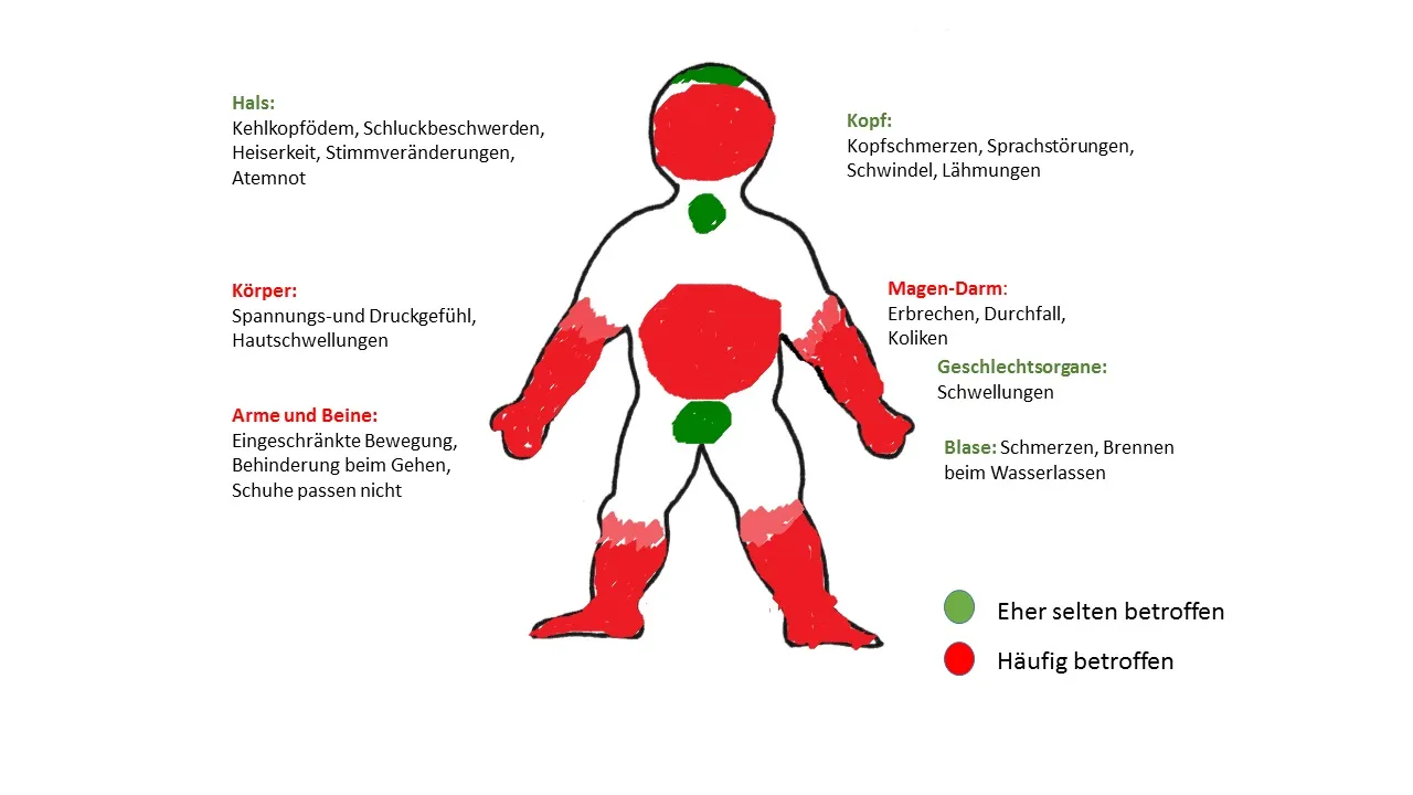 Zdjęcie Symptome von Magen Darm: Warnzeichen einer ernsten Infektion erkennen