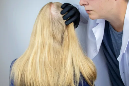 kobieta i mężczyzna z problemem wypadania włosów