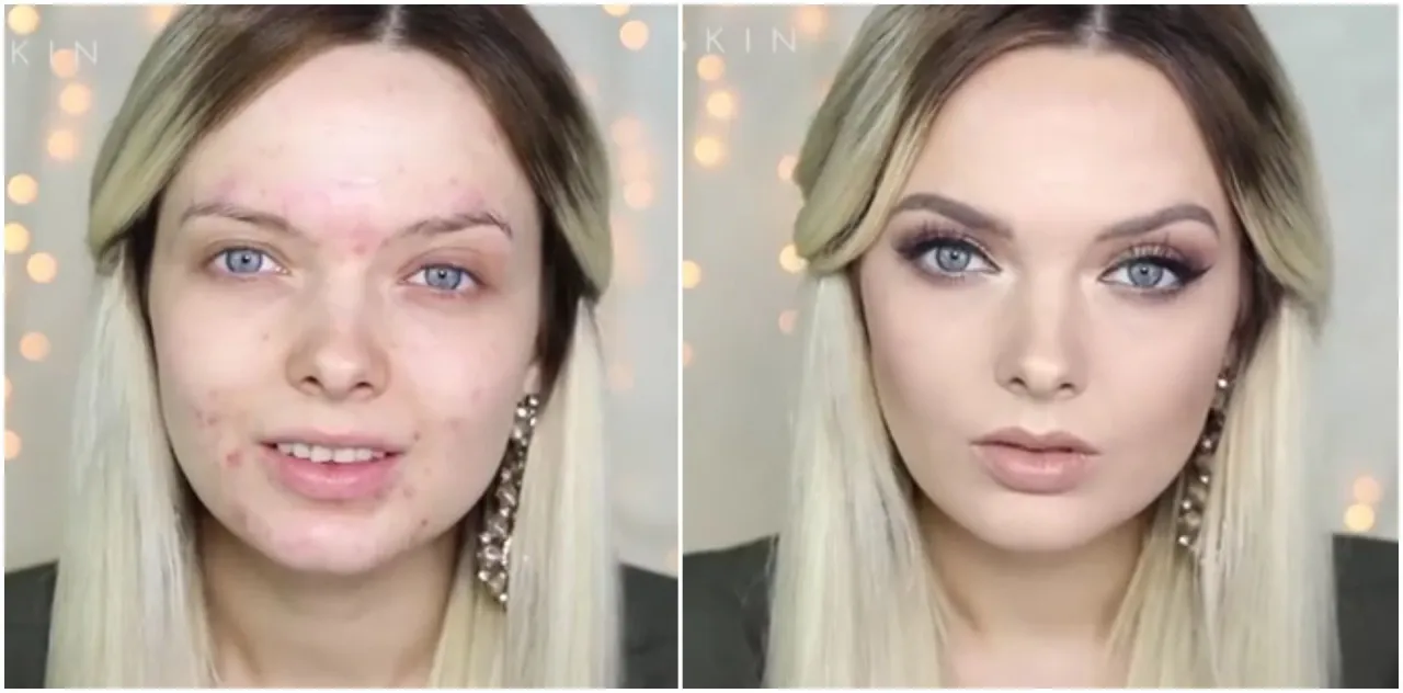 Zdjęcie Jak dobrze zakryć pryszcza i uniknąć widocznych niedoskonałości