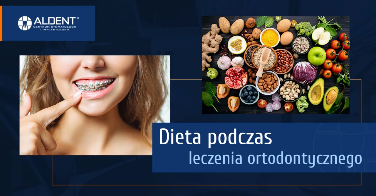 dieta miękka aparat ortodontyczny