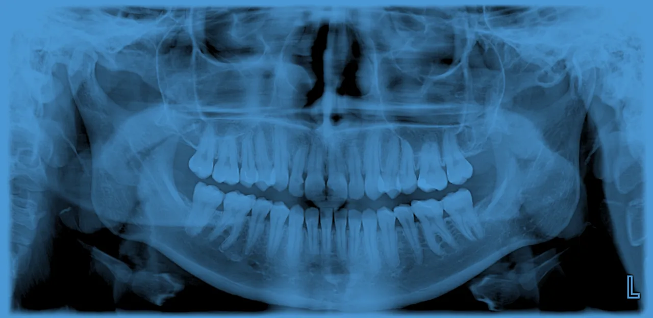 Pantomogram z opisem struktur anatomicznych