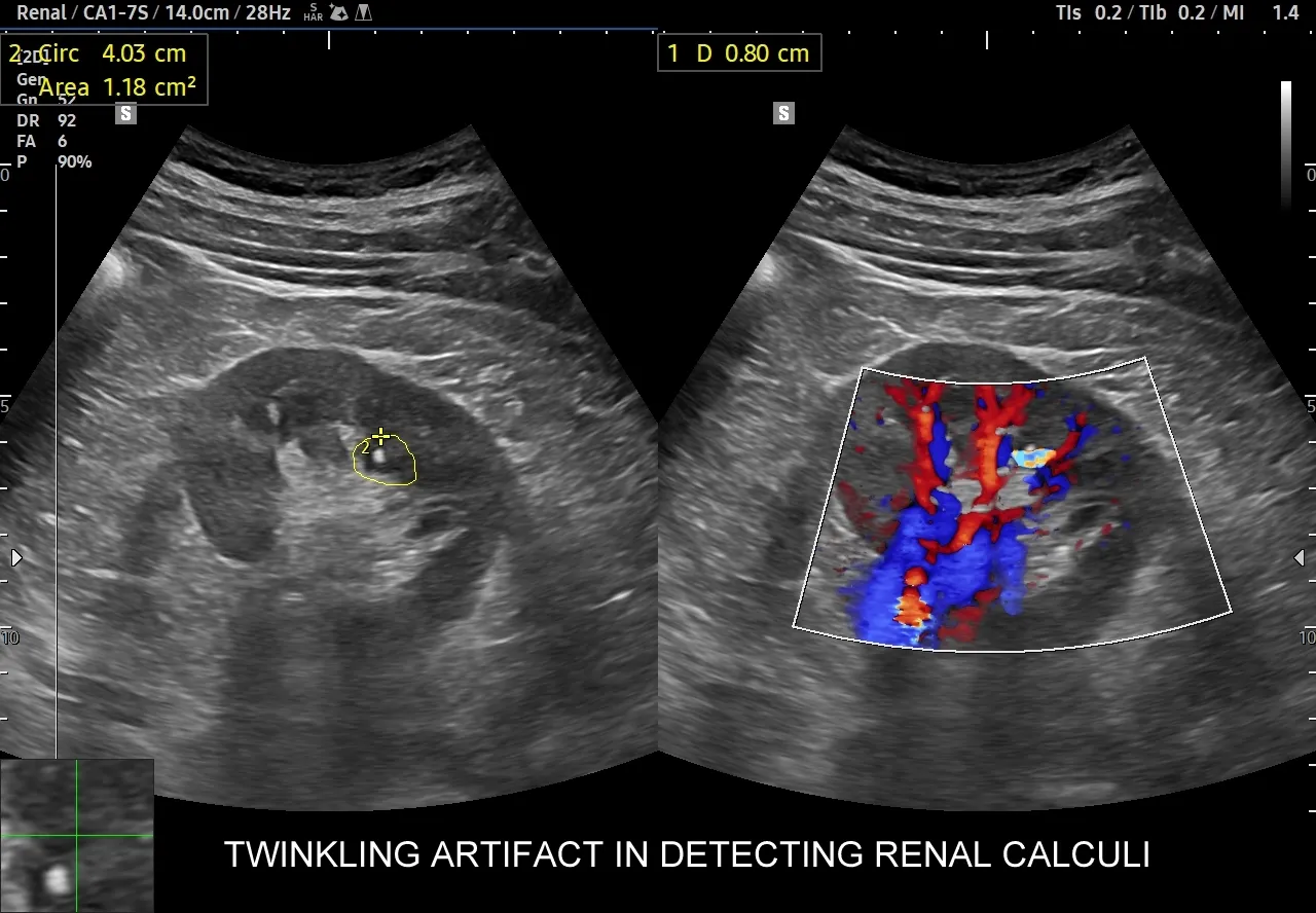 Badania diagnostyczne nerek