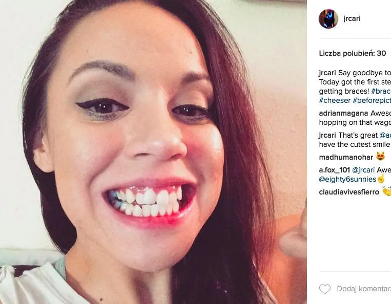 osoba z krzywymi zębami uśmiech