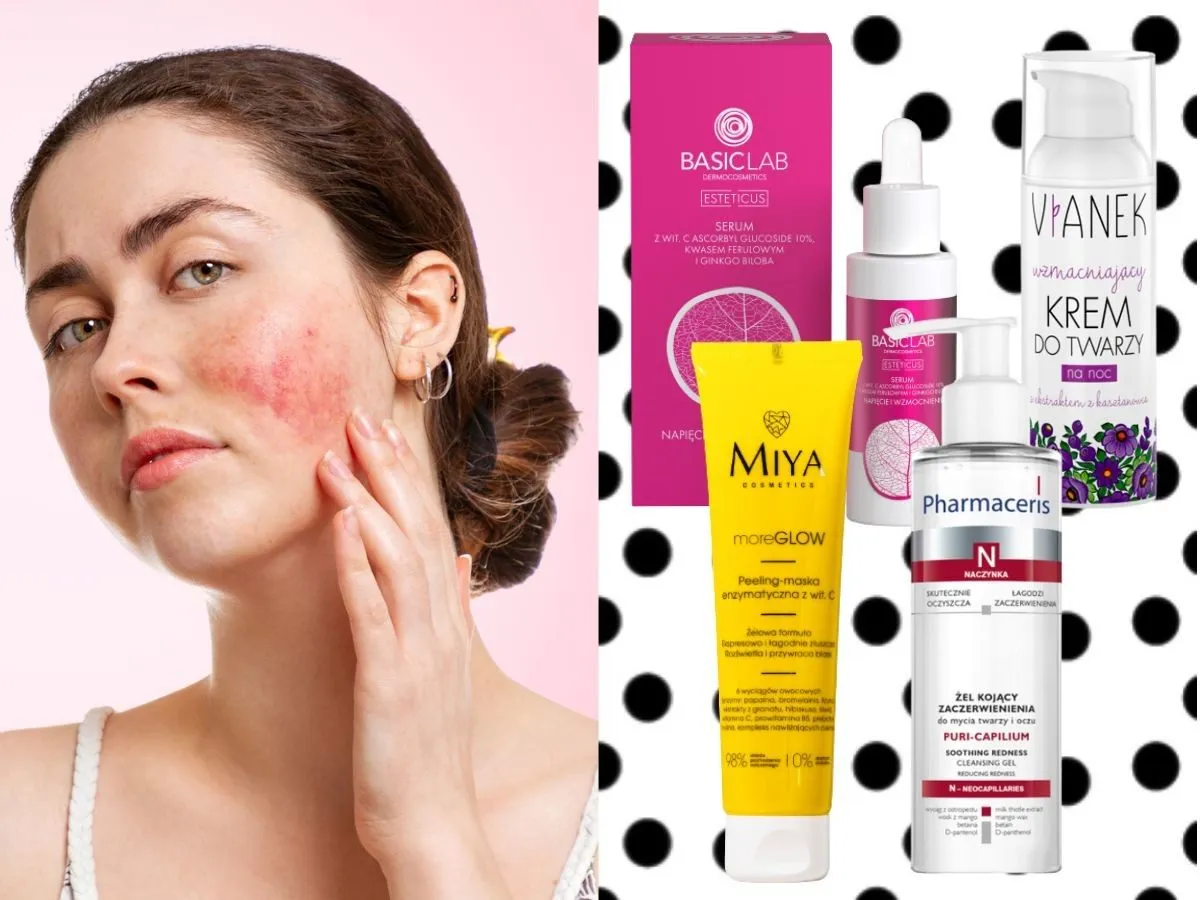 cera naczynkowa objawy i pielęgnacja