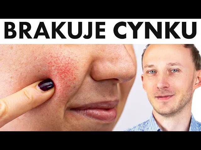 wczesne objawy niedoboru cynku grafika