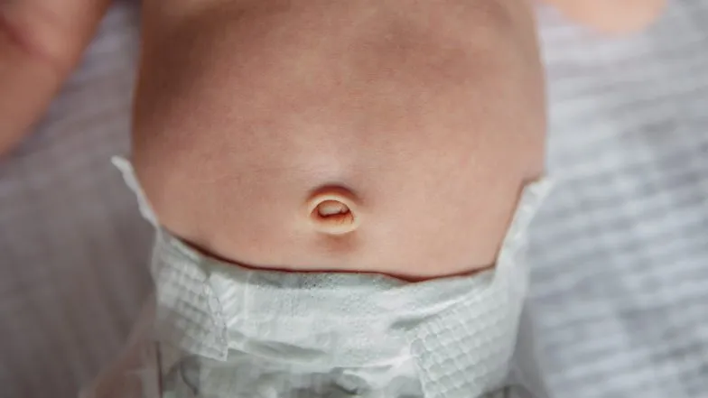 Pielęgnacja pępka noworodka