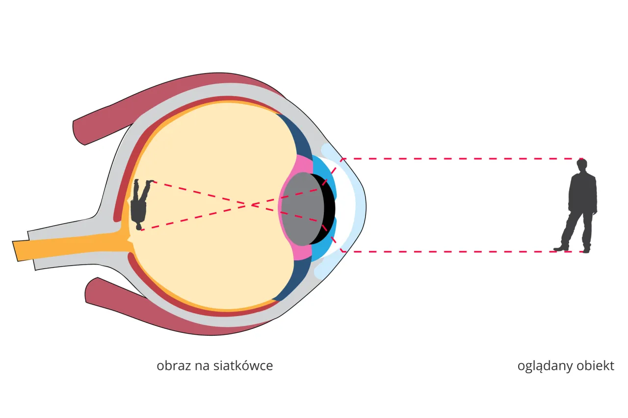 Schemat oka z zaznaczonym nerwem wzrokowym i ciśnieniem wewnątrzgałkowym