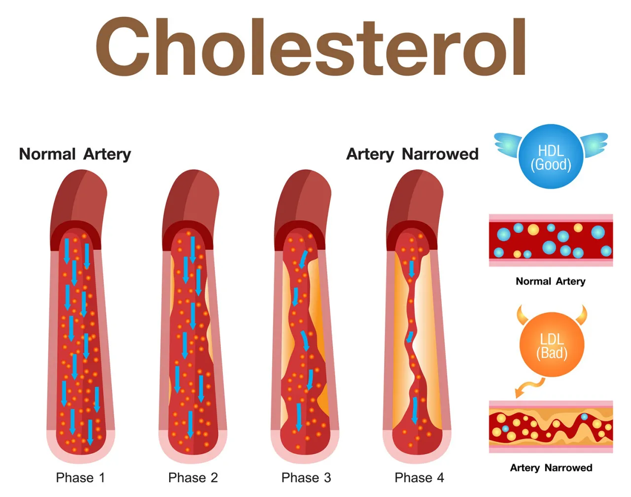 cholesterol HDL LDL porównanie