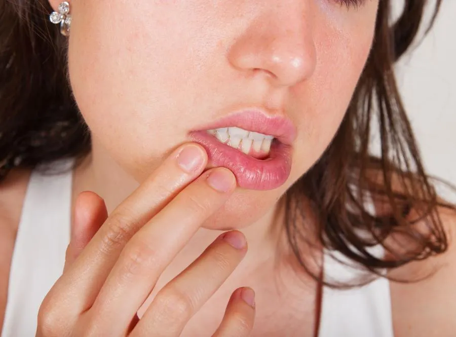 pierwsza pomoc oparzenie jamy ustnej zimna woda lód