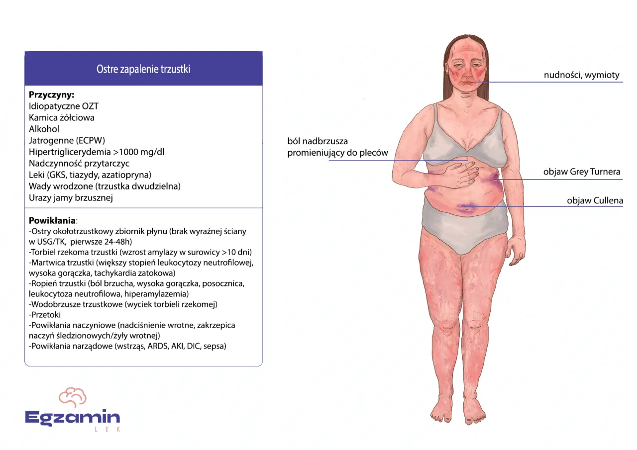 Lokalizacja trzustki i obszar b&oacute;lu