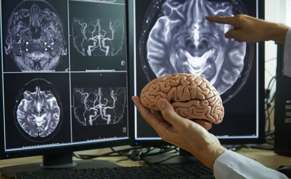 mózg depresja neuroplastyczność