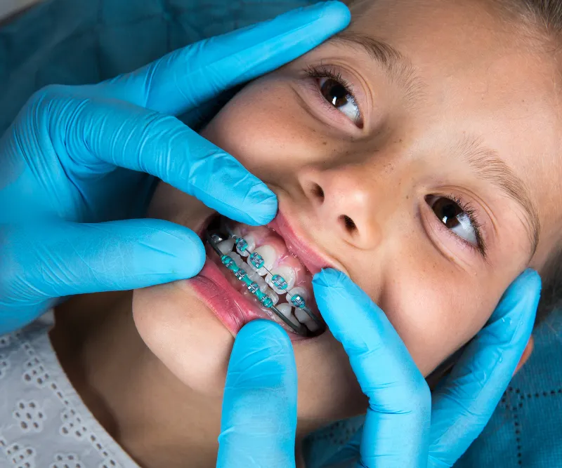 Pierwsza wizyta u ortodonty dziecka