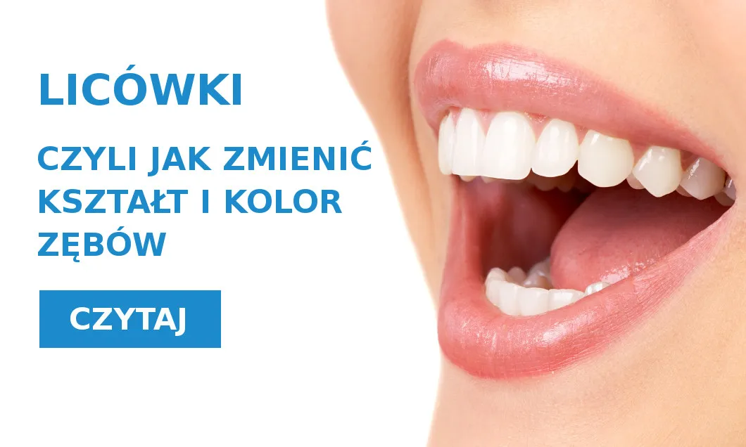 Zdjęcie Jaki kolor zębów wybrać, aby uniknąć sztucznego uśmiechu?