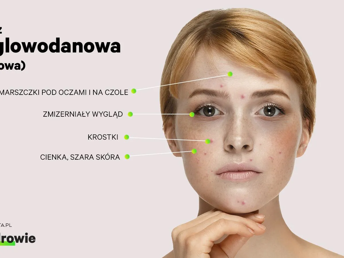 Krostki na twarzy, zmarszczki i szara skóra. Jak się ich pozbyć? Dowiedz się więcej o pielęgnacji cery.