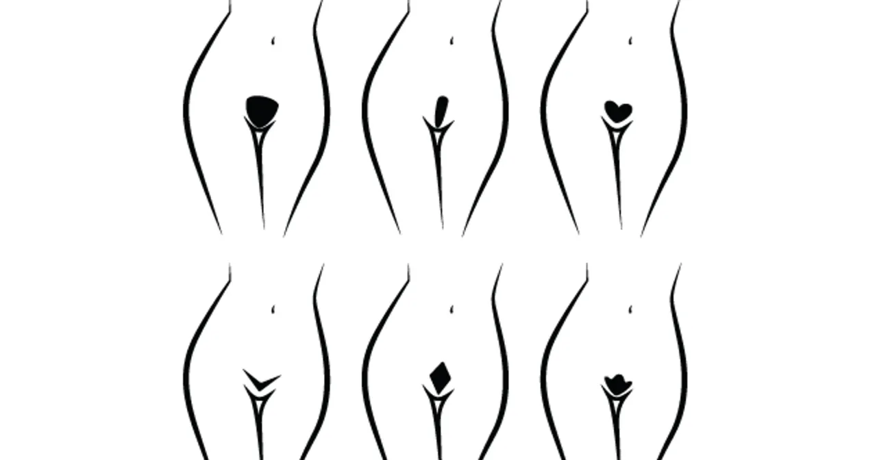 rodzaje depilacji bikini porównanie schemat