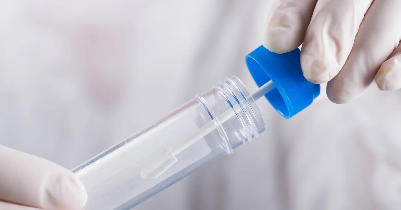 produkty dozwolone przed badaniem krwi utajonej w kale