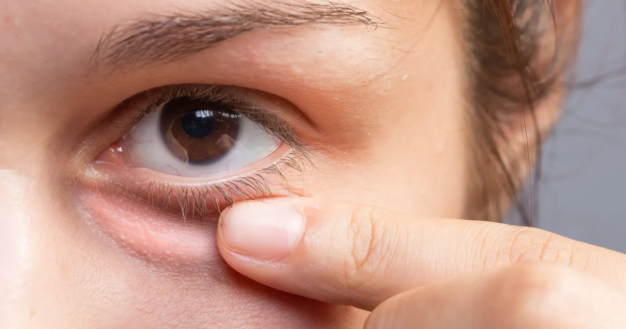 błędy makijażowe worki pod oczami