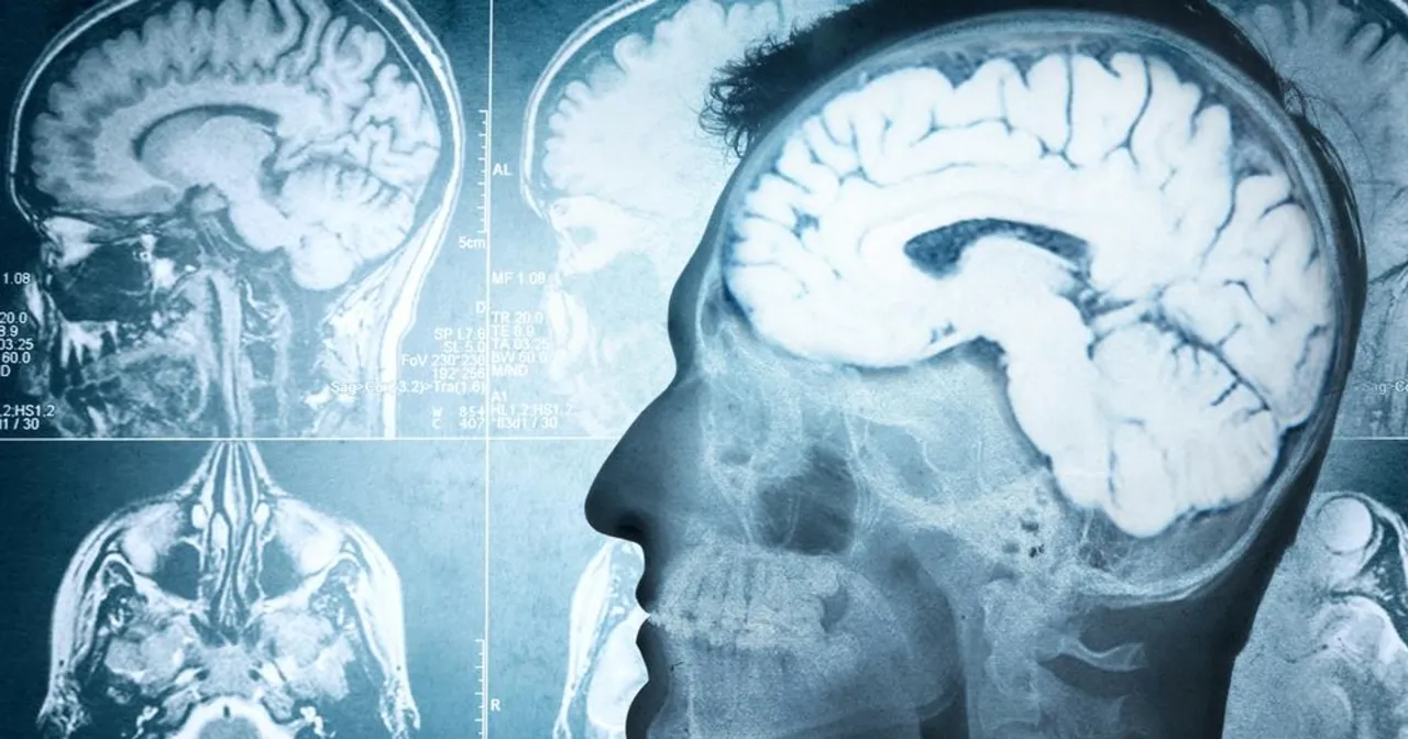 uzależnienie choroba mózgu