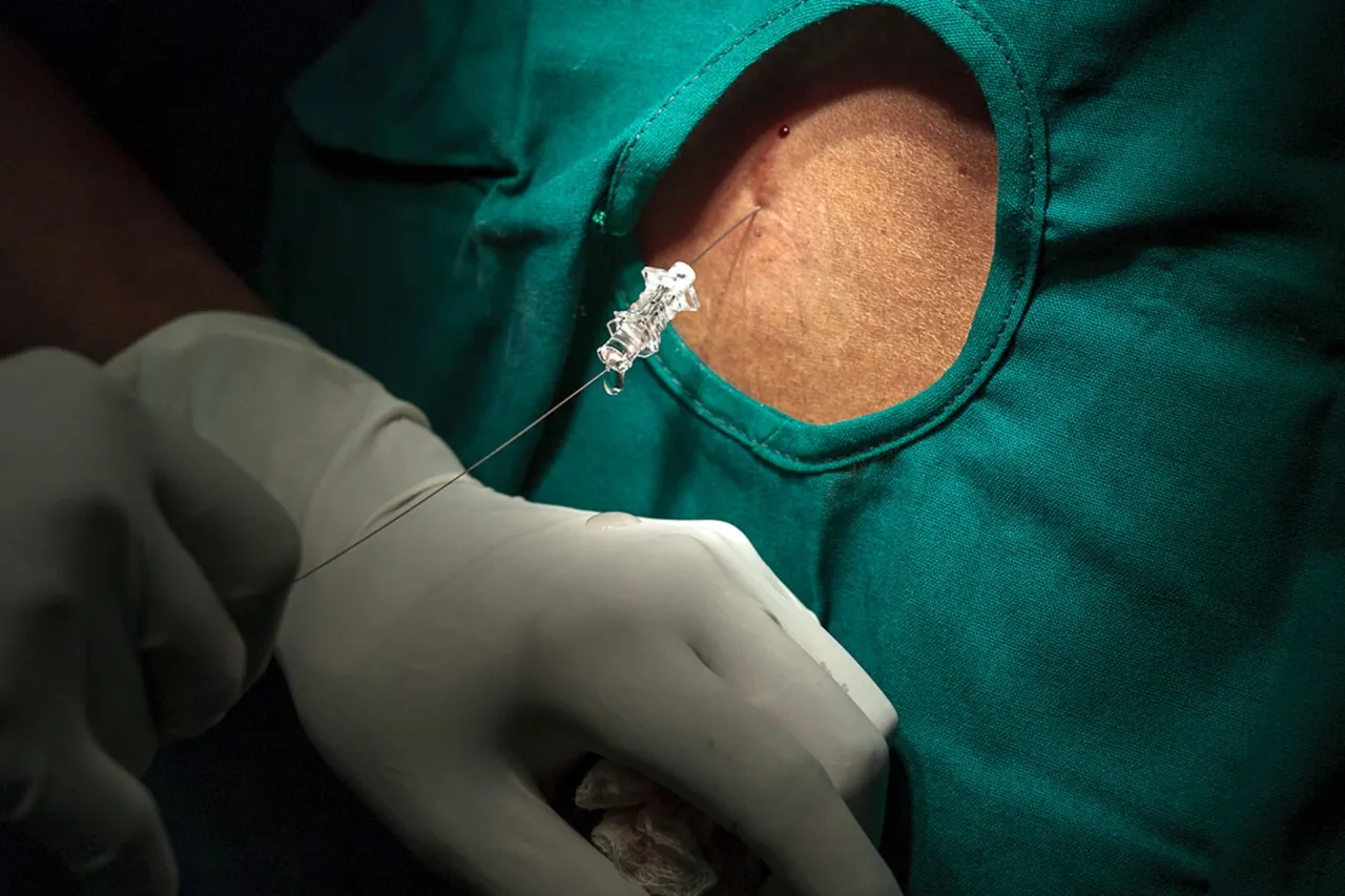 płyn m&oacute;zgowo-rdzeniowy funkcja