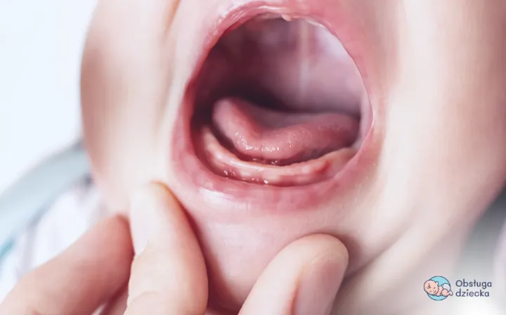 ząbkujące dziąsła niemowlaka