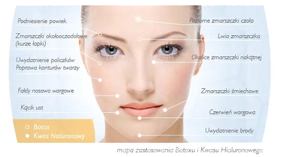 Mapa zastosowań botoksu wokół ust