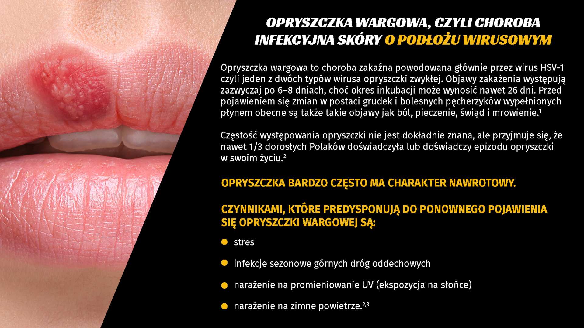 Wirus opryszczki HSV-1 pod mikroskopem