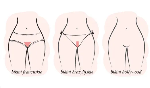 porównanie depilacji bikini płytkie francuskie brazylijskie infografika