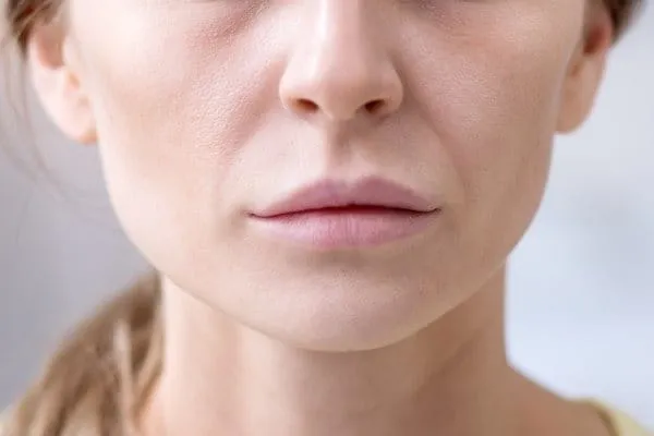 Frau mit trockener, fahler Haut und verschiedene Einflussfaktoren