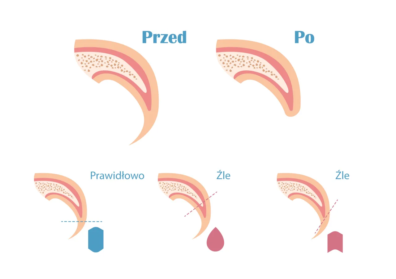 anatomia pazura psa schemat