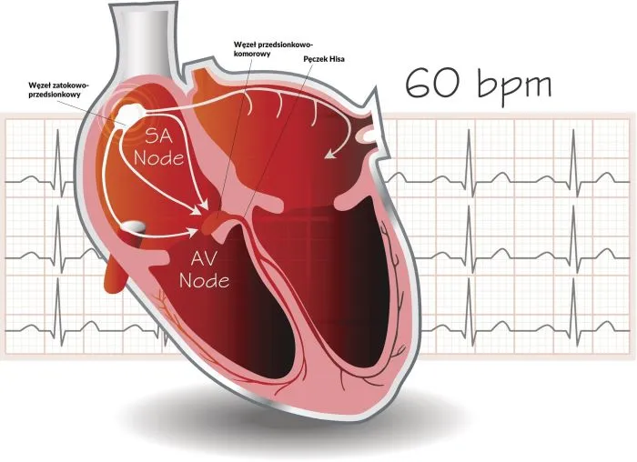 Przyczyny zaburzeń rytmu serca schemat
