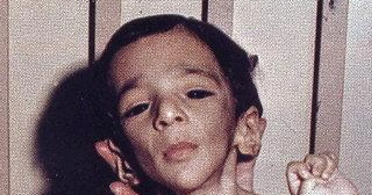 Życie z diagnozą syndromu