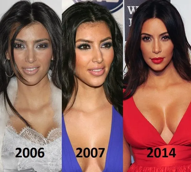 Kim Kardashian przed i po operacjach plastycznych twarz i ciało porównanie