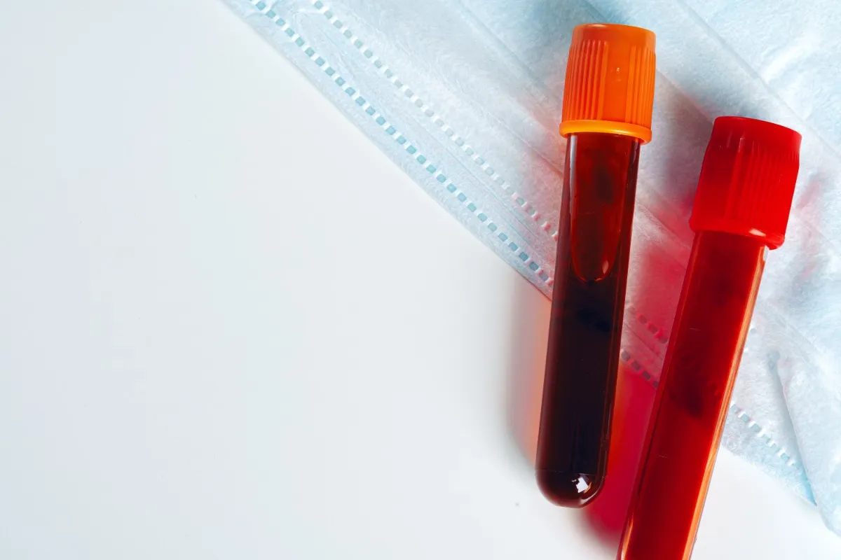 Wykres norm kreatyniny i eGFR